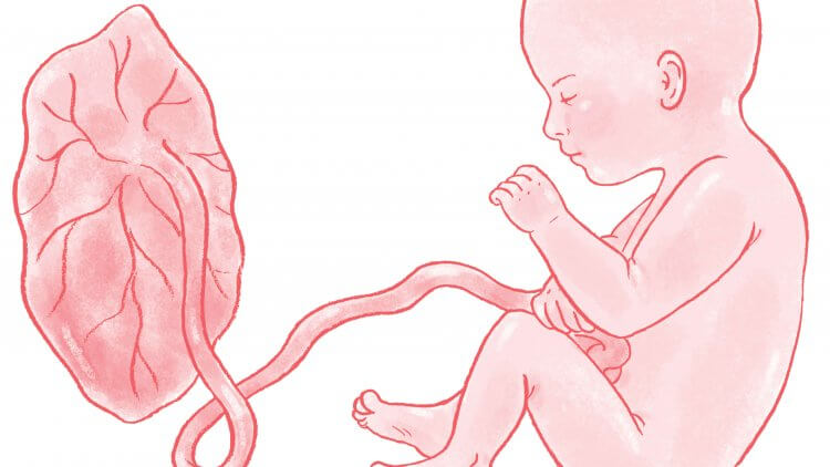 Placenta accreta is a very serious condition that can change your birth plan considerably. Find out what it is and what a natural mama can do in this post.